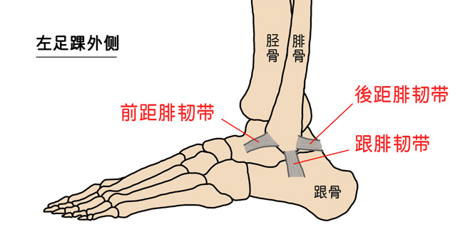 足踝扭伤最常伤及前距腓韧带