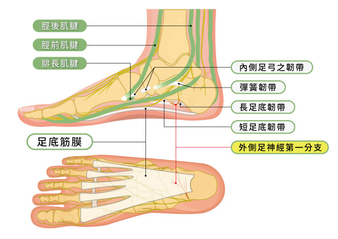 足底筋膜炎,足部肌腱,足部韌帶